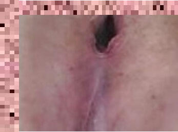 Anal Gape maintenance