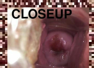 Inside Sheena - Babe with gyno spatula shows vagina closeup